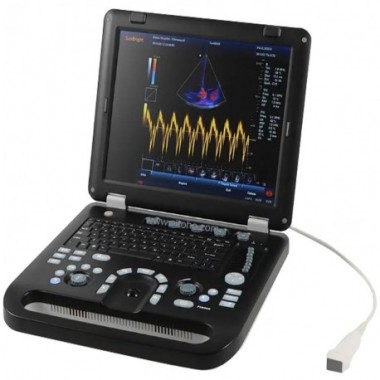 Ultrasonografi (USG) atau Laptop Color Doppler Ultrasound Scanner SLS-906A